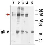 KCNH2 (HERG) (extracellular) Antibody in Immunoprecipitation (IP)