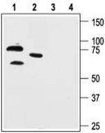 KV4.1 (KCND1) Antibody in Western Blot (WB)