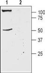 KCNK18 (TRESK) (extracellular) Antibody in Western Blot (WB)