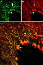 KV1.5 (KCNA5) (extracellular) Antibody in Immunohistochemistry (IHC)