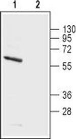 KV1.5 (KCNA5) (extracellular) Antibody in Western Blot (WB)