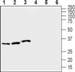 KCNE1 (IsK) Antibody in Western Blot (WB)