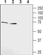 KCNQ1 (extracellular) Antibody in Western Blot (WB)