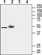 KCNK12 (THIK-2) (extracellular) Antibody in Western Blot (WB)