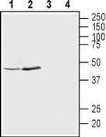 KCNK12 (THIK-2) (extracellular) Antibody in Western Blot (WB)