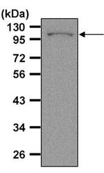 Amyloid Precursor Protein Antibody in Western Blot (WB)