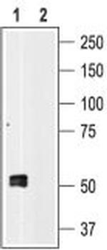 P2X1 Receptor Antibody in Western Blot (WB)