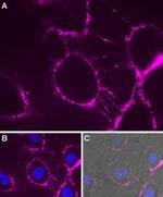 P2X7 Receptor (extracellular) Antibody in Immunocytochemistry (ICC/IF)