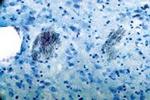 P2Y1 Receptor Antibody in Immunohistochemistry (IHC)