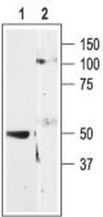 P2Y11 Receptor Antibody in Western Blot (WB)