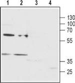 P2Y12 Receptor (extracellular) Antibody in Western Blot (WB)