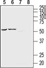 P2Y12 Receptor (extracellular) Antibody in Western Blot (WB)