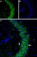 P2Y1 Receptor (extracellular) Antibody in Immunohistochemistry (IHC)