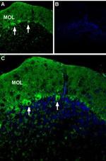 P2X1 Receptor (extracellular) Antibody in Immunohistochemistry (IHC)