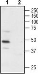 P2X3 Receptor (extracellular) Antibody in Western Blot (WB)