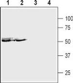 P2X5 Receptor (extracellular) Antibody in Western Blot (WB)