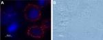 PAR1 (F2R) (extracellular) Antibody in Immunocytochemistry (ICC/IF)