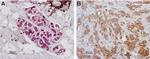 PAR1 (F2R) (extracellular) Antibody in Immunohistochemistry (Paraffin) (IHC (P))