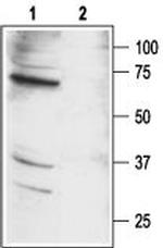 PAR2 (F2RL1) Antibody in Western Blot (WB)