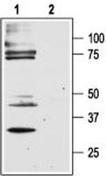 PAR2 (F2RL1) Antibody in Western Blot (WB)