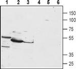 PTH1R (extracellular) Antibody in Western Blot (WB)