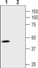 Prostaglandin E Receptor EP3 (PTGER3) Antibody in Western Blot (WB)