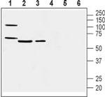 Prostacyclin Receptor (PTGIR) (extracellular) Antibody in Western Blot (WB)