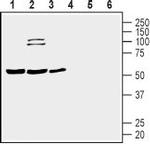 Prostacyclin Receptor (PTGIR) (extracellular) Antibody in Western Blot (WB)