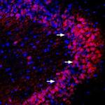 PICK1 Antibody in Immunohistochemistry (Frozen) (IHC (F))