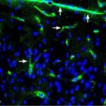 alpha 1-Syntrophin (SNTA1) Antibody in Immunohistochemistry (Frozen) (IHC (F))