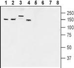 AKAP150 Antibody in Western Blot (WB)