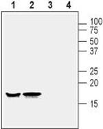 Alpha-Synuclein Antibody in Western Blot (WB)