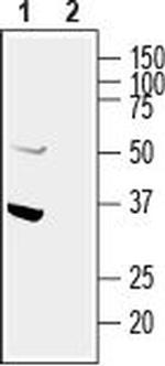 GIPC1 Antibody in Western Blot (WB)