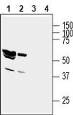 GIPC1 Antibody in Western Blot (WB)