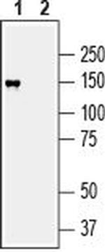 MAGI2/AIP1 Antibody in Western Blot (WB)