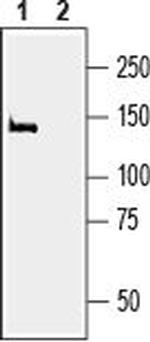 MAGI2/AIP1 Antibody in Western Blot (WB)