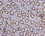 Aquaporin 2 Antibody in Immunohistochemistry (Paraffin) (IHC (P))