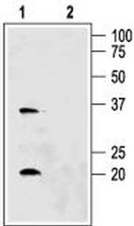 Aquaporin 6 Antibody in Western Blot (WB)