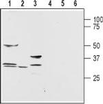 Aquaporin 9 Antibody in Western Blot (WB)