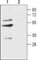 Aquaporin 9 Antibody in Western Blot (WB)