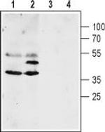 Aquaporin 4 (AQP4) (300-314) Antibody in Western Blot (WB)