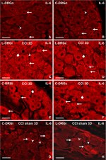 IL-6 Antibody in Immunohistochemistry (IHC)