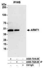 ARMT1 Antibody in Western Blot (WB)