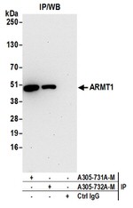 ARMT1 Antibody in Western Blot (WB)