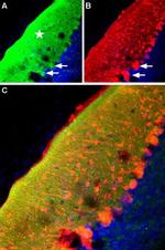 Ryanodine Receptor 2 Antibody in Immunohistochemistry (Frozen) (IHC (F))