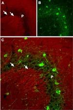 SCN2A (NaV1.2) Antibody in Immunohistochemistry (IHC)