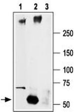 SCN2A (NaV1.2) Antibody in Immunoprecipitation (IP)