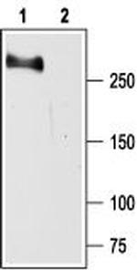 SCN2A (NaV1.2) Antibody in Western Blot (WB)