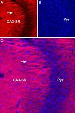 SCN2A (NaV1.2) Antibody in Immunohistochemistry (IHC)