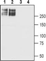 SCN2A (NaV1.2) Antibody in Western Blot (WB)